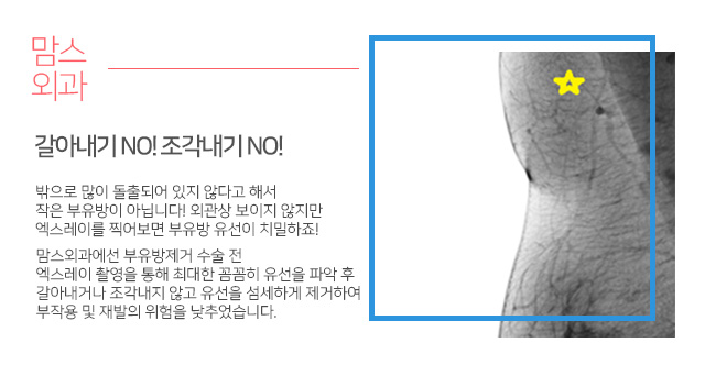 부유방수술후기 근본을찾아서 관련 이미지 4