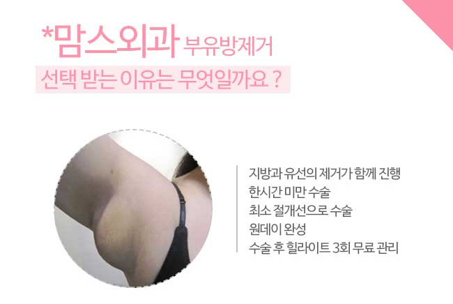 부유방제거 보다안전하게 관련 이미지 3