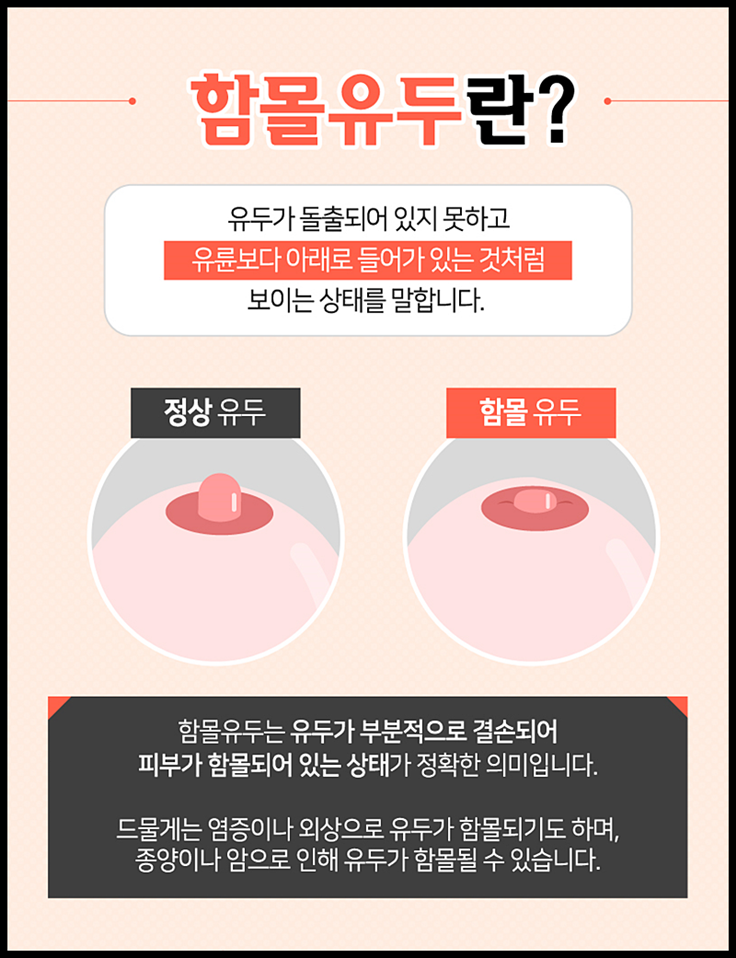 함몰유두수술비용 올바른 선택을 위해서는? 관련 이미지 2