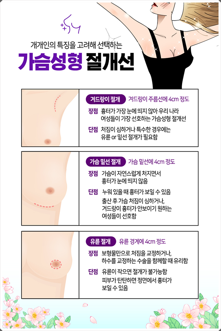 벨라젤마이크로 내 체형에 맞는 변화 관련 이미지 6
