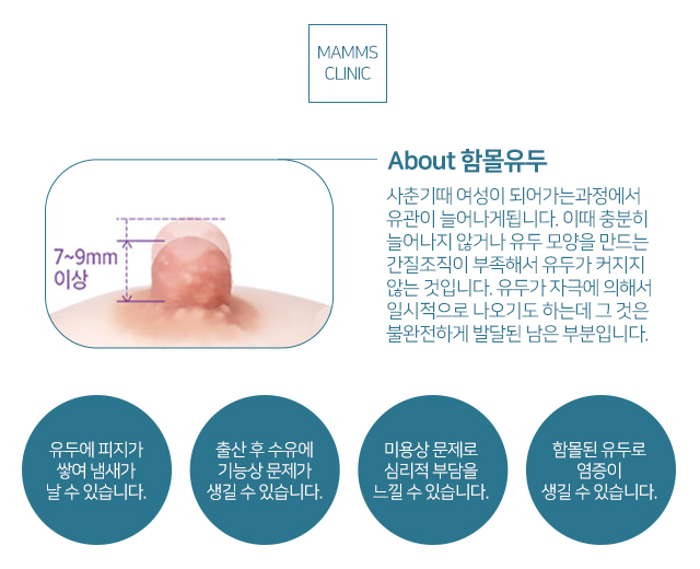 여성함몰유두 이젠극복 관련 이미지 2