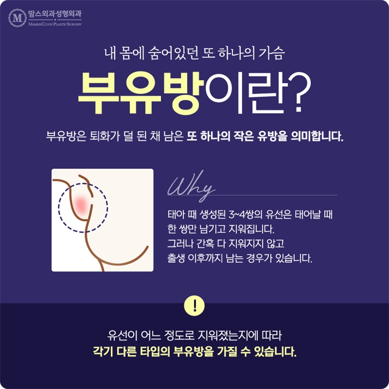 What Should You Choose for Axillary Accessory Breast Removal? image 2