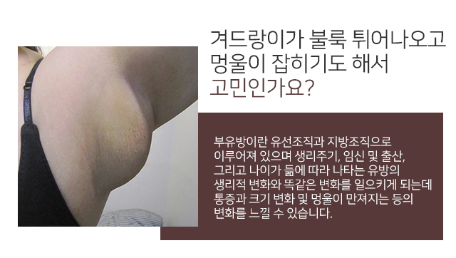 부유방주사 보다근본적으로 관련 이미지 2