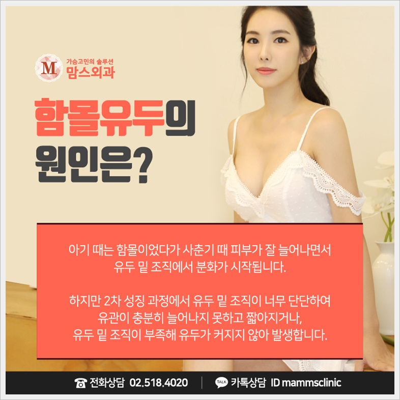 함몰유두수술과 처진 가슴도 동시에 관련 이미지 4