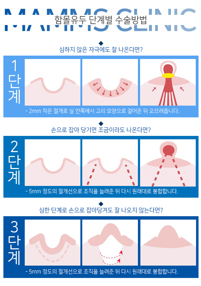 편평유두 너무걱정된다면 관련 이미지 3