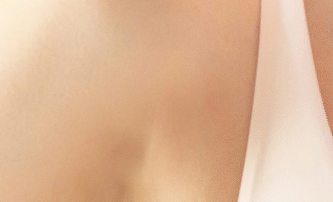 Personalized Accessory Breast Surgery Tailored to Your Axillary Skin Condition! image 16