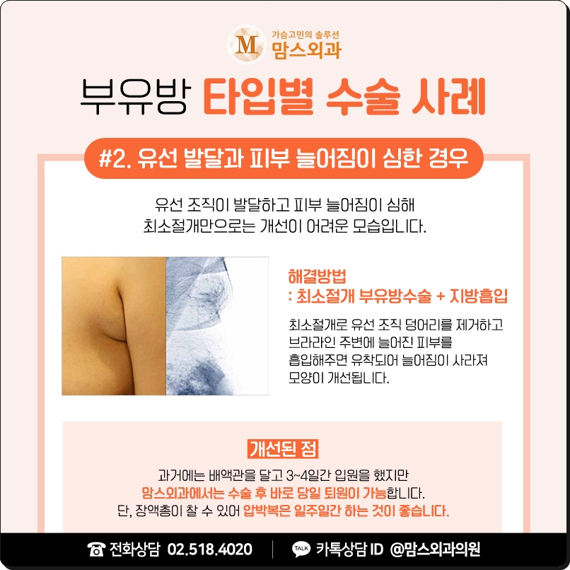 부유방수술병원 당당함을 원한다면 관련 이미지 6