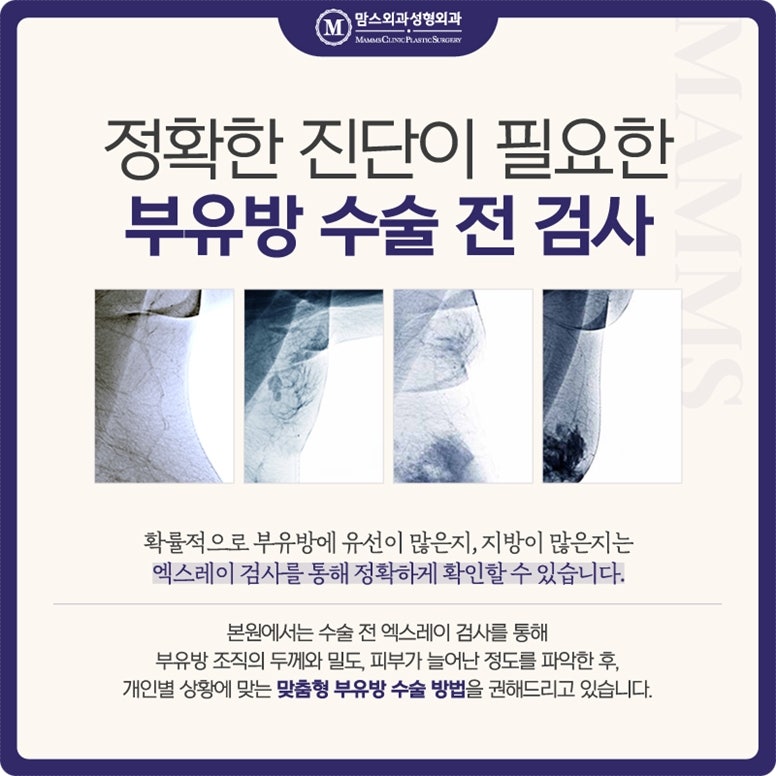 What Should You Choose for Axillary Accessory Breast Removal? image 7