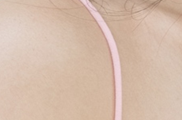 겨드랑이 몽우리 걱정스럽나요? 관련 이미지 19