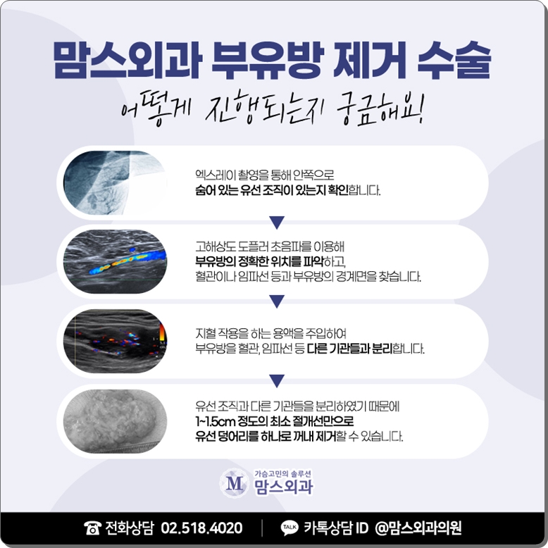 겨드랑이부유방제거비용 체크해볼까? 관련 이미지 8