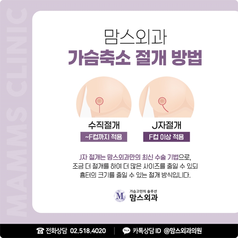 가슴축소수술방법 좀더 깔끔하게 관련 이미지 8