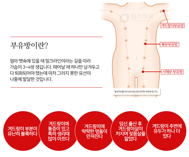 겨드랑이 밑 통증 큰일은아닐까 관련 이미지 2