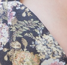 부유방제거수술 생각을 다지고 관련 이미지 23
