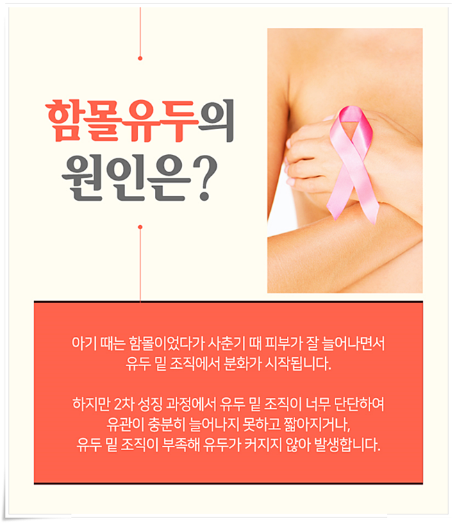 함몰유두 원인 아직까지 몰랐었지 관련 이미지 3