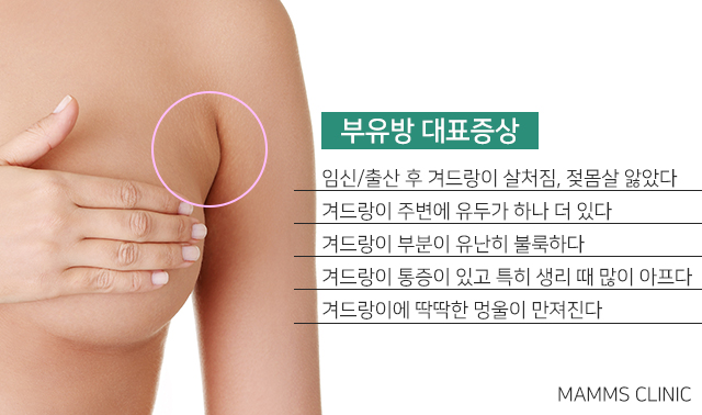 부유방수술후기 깔끔하게 관련 이미지 2