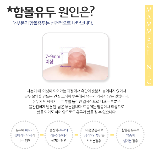 함몰유두수술부작용 적합한 수술 방법은? 관련 이미지 2