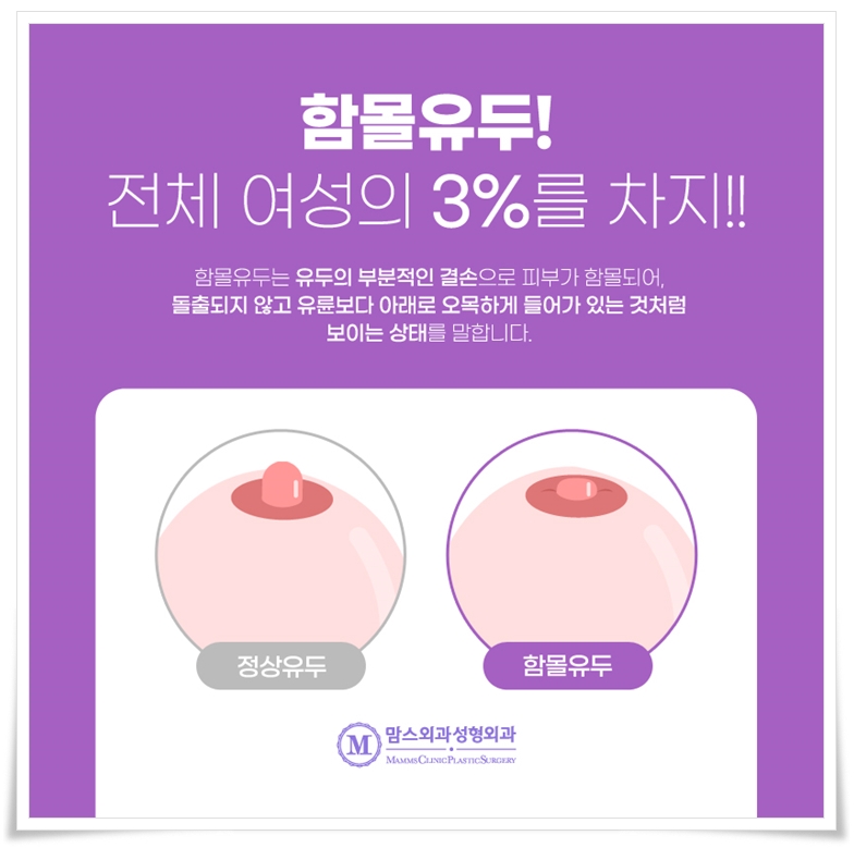 함몰유두교정 수술, 제대로 알기 관련 이미지 3