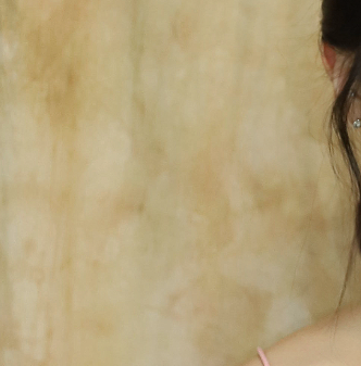 How Can a Systematic Management Method Help Fade Breast Reduction Scars? image 15