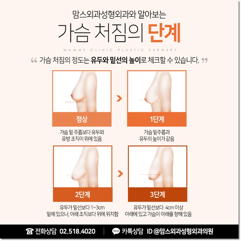 처진가슴교정 당당함을 담다 관련 이미지 6