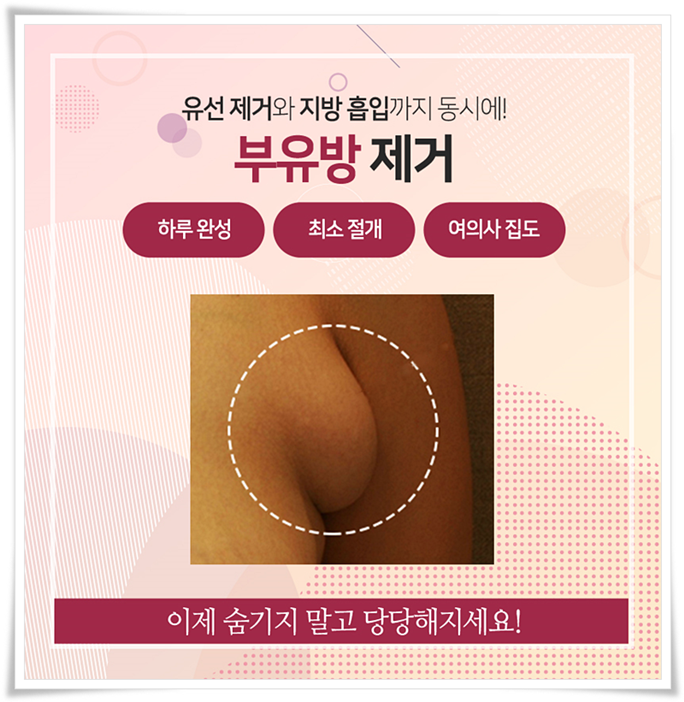 부유방수술 평소에 신경이 쓰였다면 관련 이미지 1