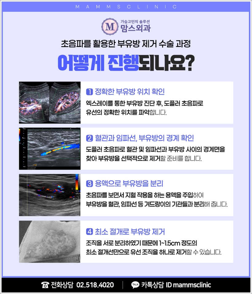 부유방겨드랑이통증 덜어내고 싶다면 관련 이미지 8