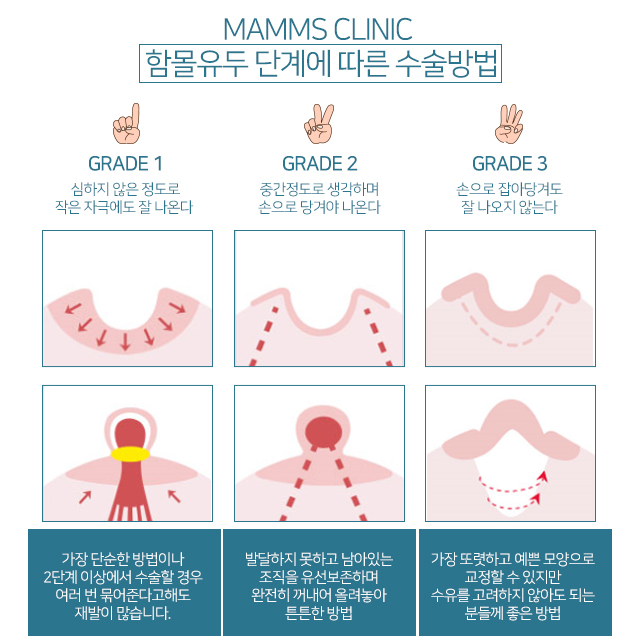 여성함몰유두 이젠극복 관련 이미지 3