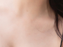 Areolar Surgery, Done Right in Just One Procedure! Toward Balanced Beauty image 16