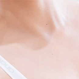 What Should You Choose for Axillary Accessory Breast Removal? image 17