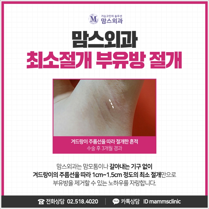 부유방겨드랑이통증 덜어내고 싶다면 관련 이미지 6