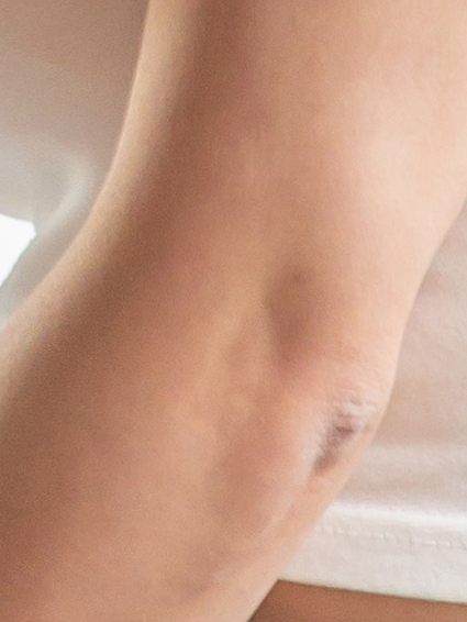 함몰유두수술후기 오직 나를 위한 관련 이미지 25