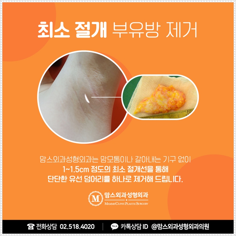 Why You Should Look Into Armpit Pain! image 6