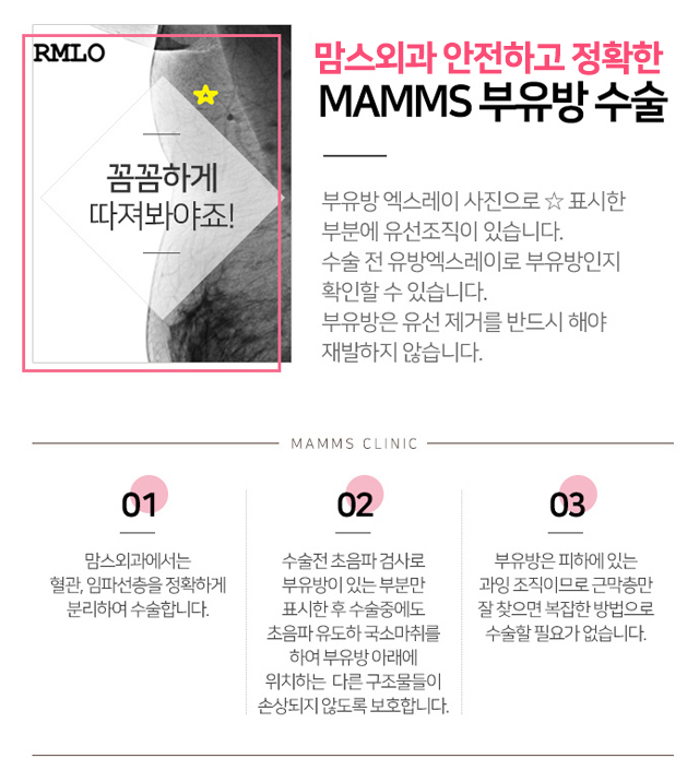 부유방제거수술 믿을수있는곳에서 관련 이미지 4