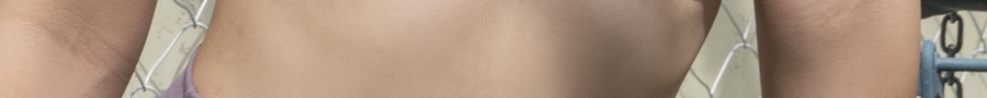 Identify the Cause of Armpit Pain image 21