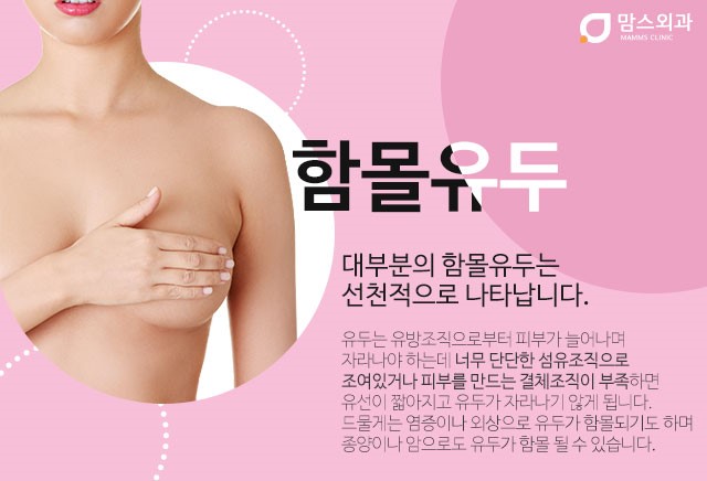 함몰유두재수술 걱정없이해야죠 관련 이미지 2