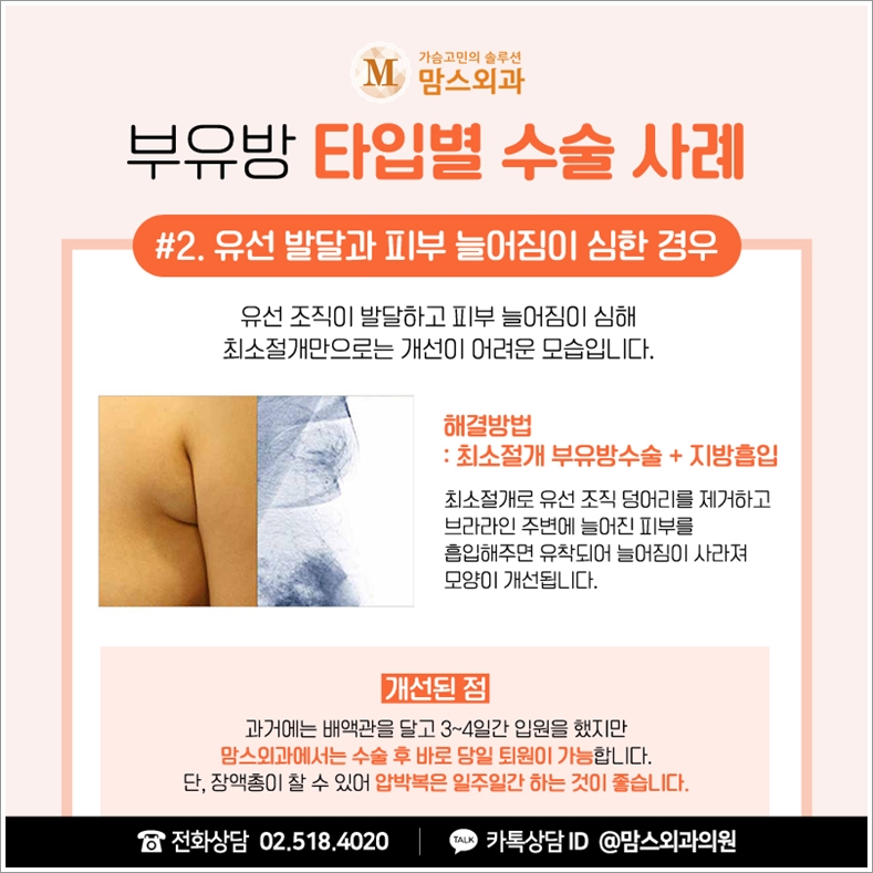 겨드랑이멍울병원 혼자 판단하기 어렵다면! 관련 이미지 6