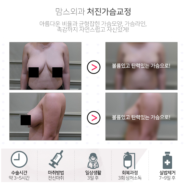 처진가슴교정 안전까지생각 관련 이미지 4