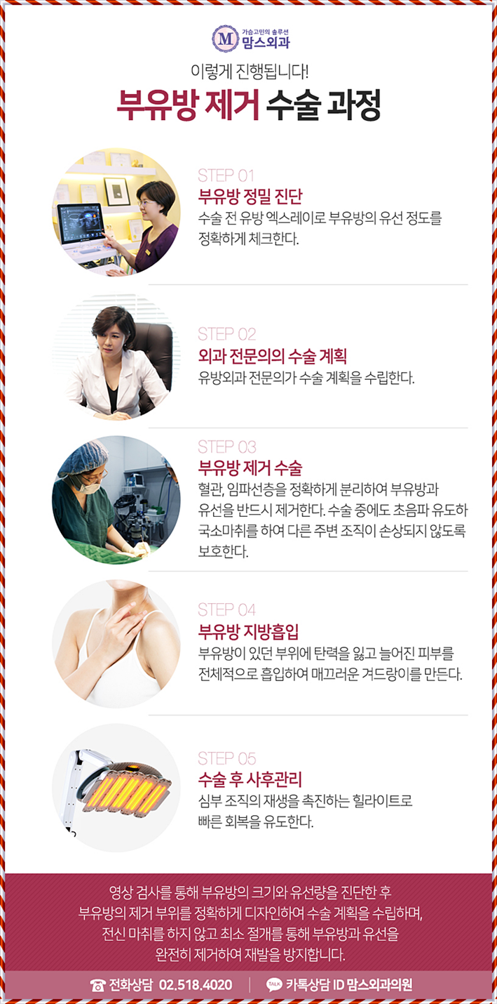 부유방수술 더 예쁜 라인을 위해! 관련 이미지 10