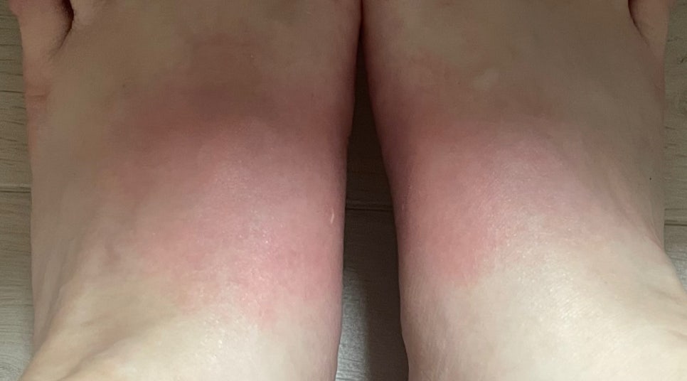 비오는 날 슬리퍼 신고 나갔다가..ㅠㅠ 관련 이미지 1