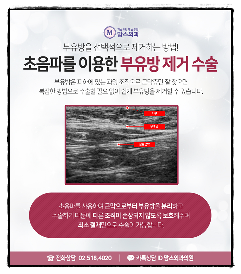 겨드랑이살빼는법 혼자서는 힘들지! 관련 이미지 5