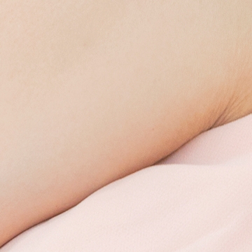 Could the protruding underarm bulge be an accessory breast instead of fat? image 20