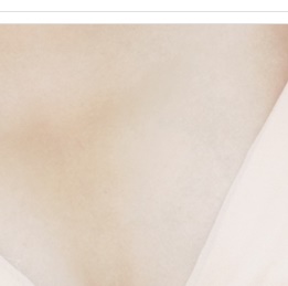 함몰유두교정 수술, 제대로 알기 관련 이미지 17