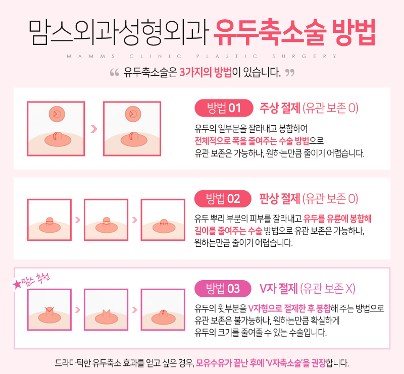 유륜축소수술비용 투명하고 합리적인 곳에서 관련 이미지 4