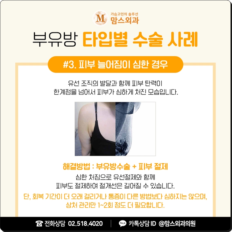 부유방통증 겪고 있다면? 관련 이미지 7