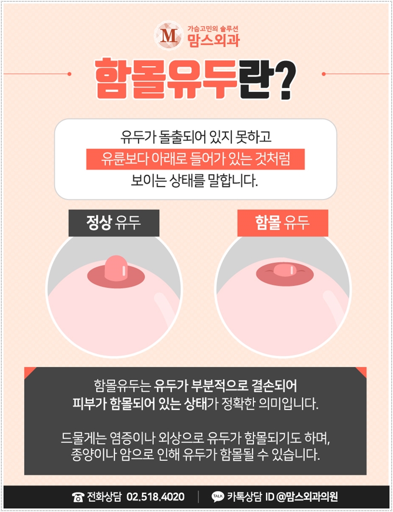 함몰유두수술 적합한 기법으로 관련 이미지 3