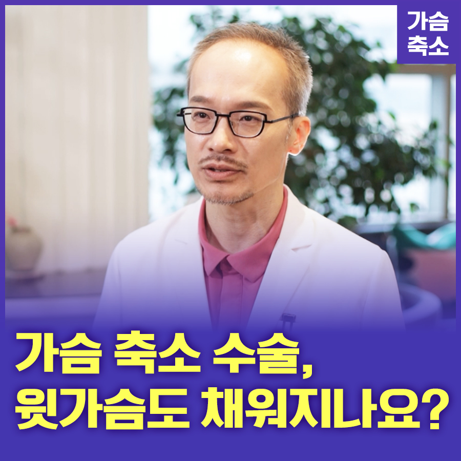 Breast Reduction Surgery: Does It Also Fill the Upper Breast? image 1