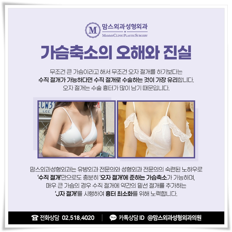 가슴축소수술 가격, 무엇을 봐야할까? 관련 이미지 5