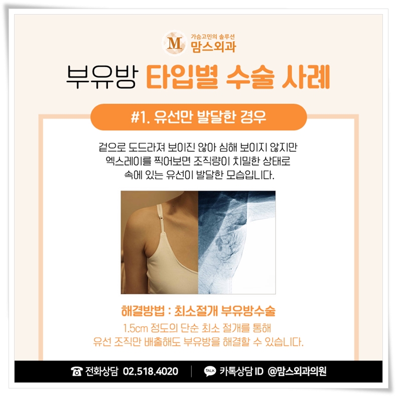 겨드랑이멍울통증 신경쓰인다면 관련 이미지 5