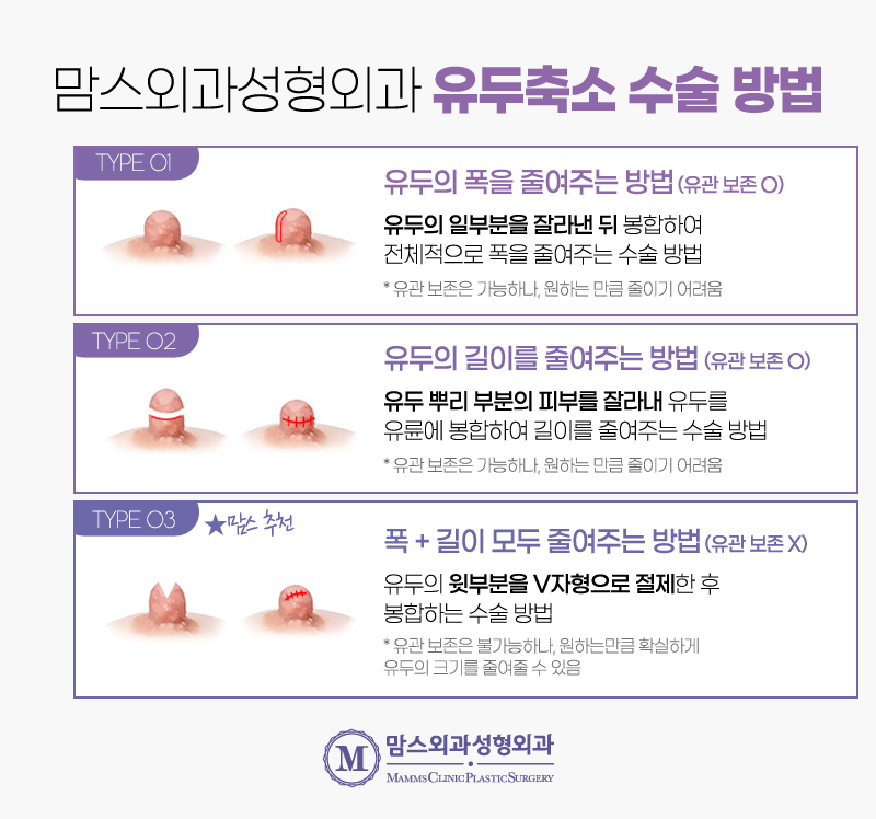유두축소수술비용 얼마나 나올까요? 관련 이미지 5