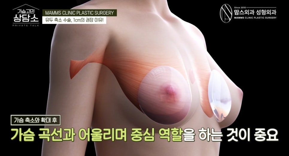 유두 크기에도 황금비율이 있다? 유두 축소 수술, 1cm가 중요한 이유 관련 이미지 3