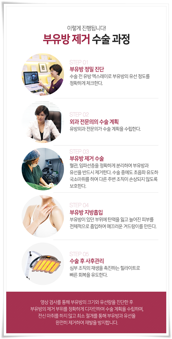 부유방수술 평소에 신경이 쓰였다면 관련 이미지 11